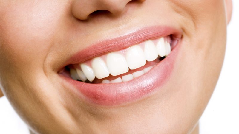 Laughing woman smile with great teeth.